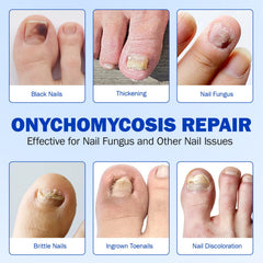 Mcukv Nail Repair Patches travel-friendly design, discreet wear