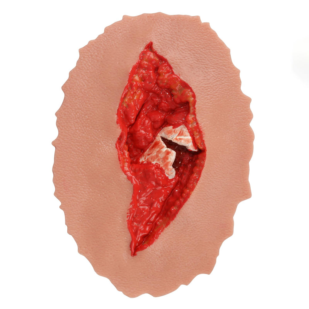 MedEduQuest wound packing trainer with open fracture wound for hands-on training