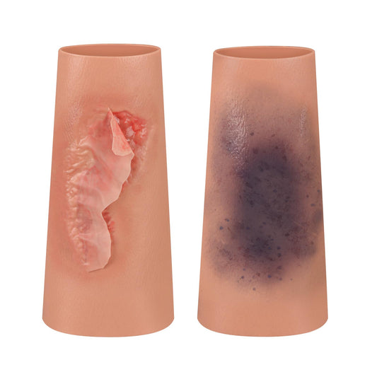 MedEduQuest abrasion wound sleeve offers lifelike texture for realistic wound care practice.