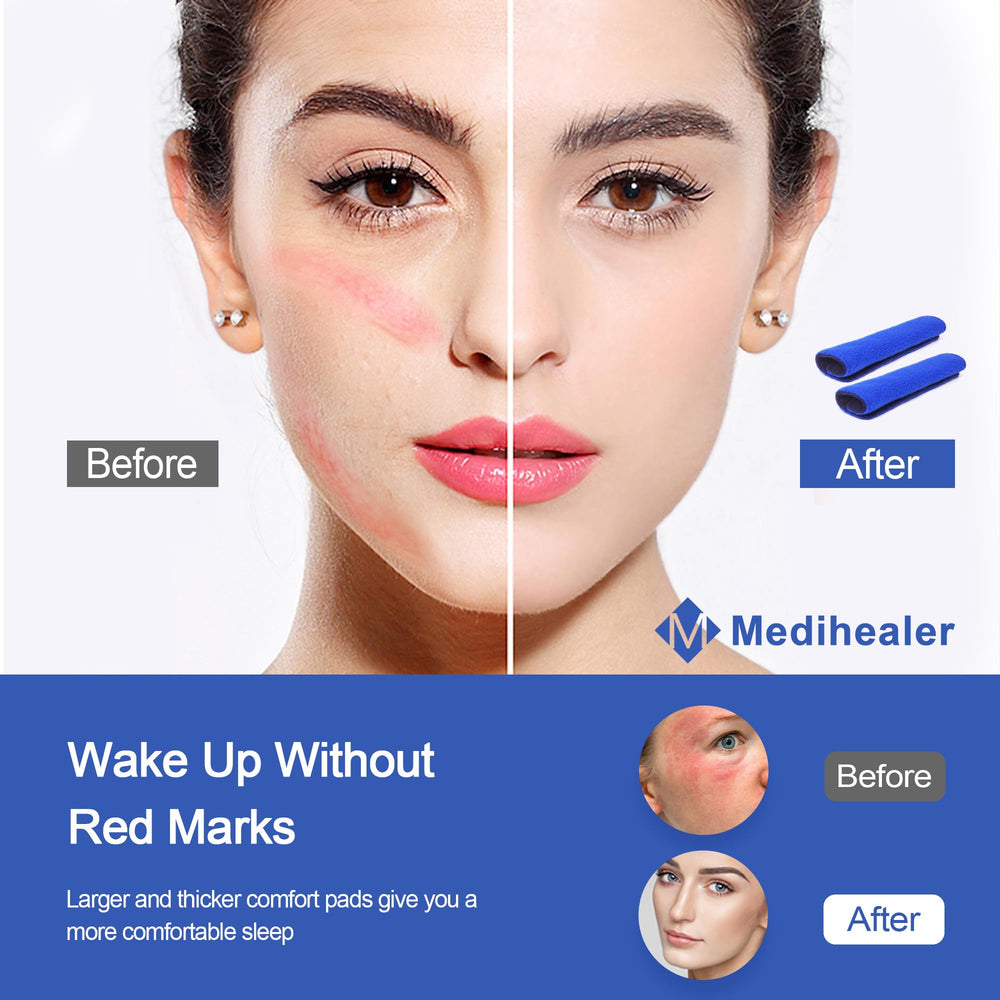 Medihealer deluxe strap pack helps reduce pressure points and red marks.
