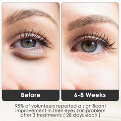 mhpoycd eye mask modes and timer highlight customizable sessions for comfort