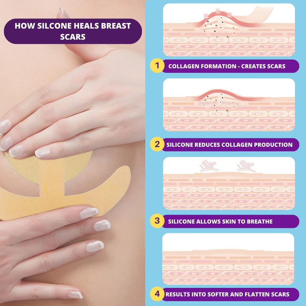 Miztag Breast Scar Tape placed on the breast area for discreet coverage.