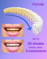 MySmile box label highlights USA-made formula and professional trust