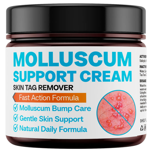 NateNatenight Molluscum Support Cream tube for gentle daily care of molluscum bumps.