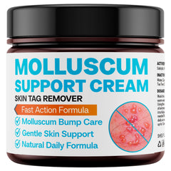 NateNatenight Molluscum Support Cream tube for gentle daily care of molluscum bumps.