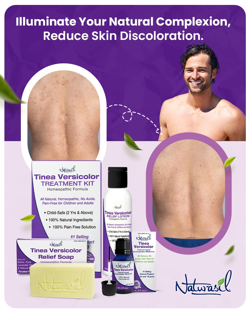 Naturasil Tinea Versicolor pack soap suds demonstrate gentle cleansing