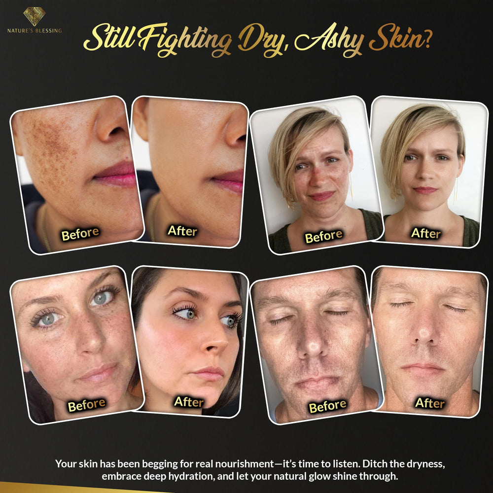 Nature's Blessing vitamin-rich formula supports skin elasticity
