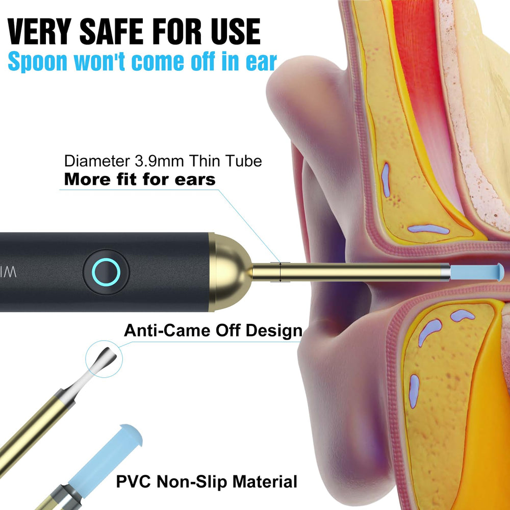 NIUQICT endoscope supports multi‑use inspections for ears and small areas.