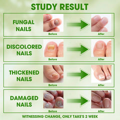 Nodfens stainless steel tweezers aid accurate patch placement.