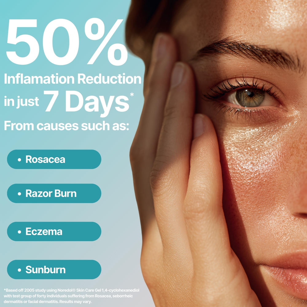 Noredol Skin Care Gel moisture-rich formula hydrates dry areas and soothes irritation
