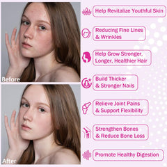 NutraNourish collagen types I–X blend for versatile beauty and joint care.