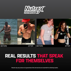Nutrex Research Lipo-6 Black Ultra Concentrate product image showing energy and focus support