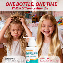 Ten minute contact time with OKARZY lice lotion before rinsing