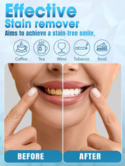 OLLM Dual blue-red LED lights aid whitening and reduce sensitivity