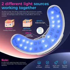 OMNIGAG Nail Fungus Laser Device in action on a nail surface
