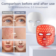 ONLUKY LED beads closeup highlighting dense array for effective exposure