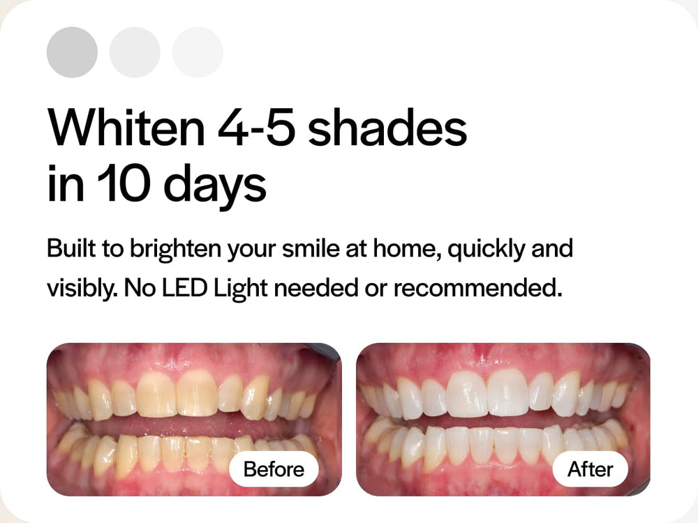 Low-sensitivity Opalescence formula designed to minimize discomfort during whitening.