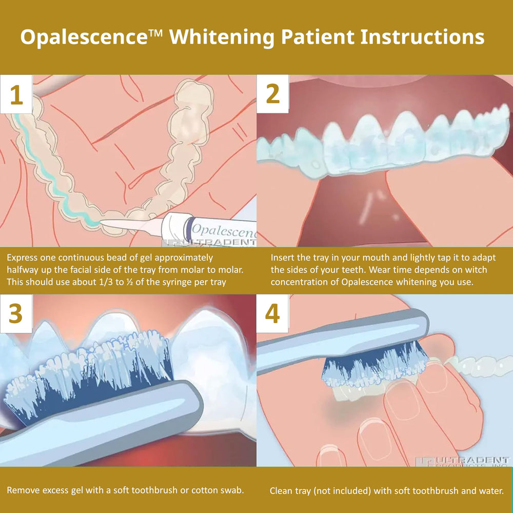 Opalescence tray compatibility image showing Invisalign and custom trays support