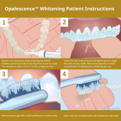 Opalescence tray compatibility image showing Invisalign and custom trays support