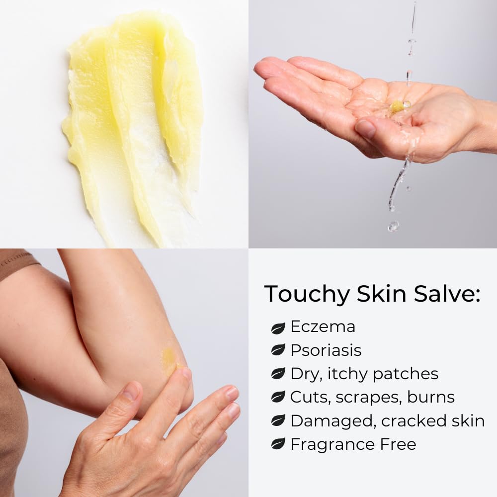 Applying Ora's Touchy Skin Salve to hands