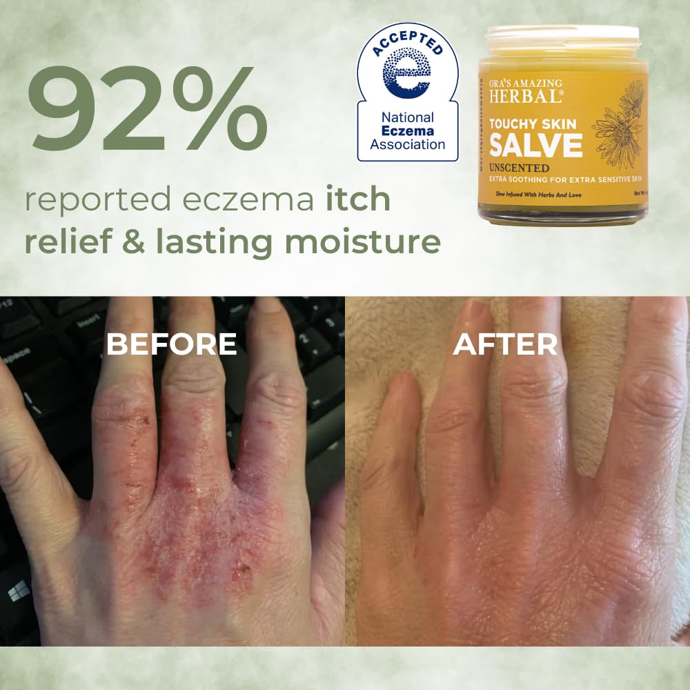 Touchy Skin Salve travel size packaging convenient for on-the-go care by Ora's Amazing Herbal.