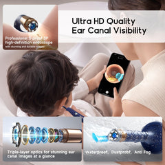 Oushome BEBIRD soft-tip scooper enables gentle, safe wax removal for all ages