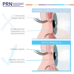 Spoon-dose of PRN DE Omega presented as a simple daily ritual.