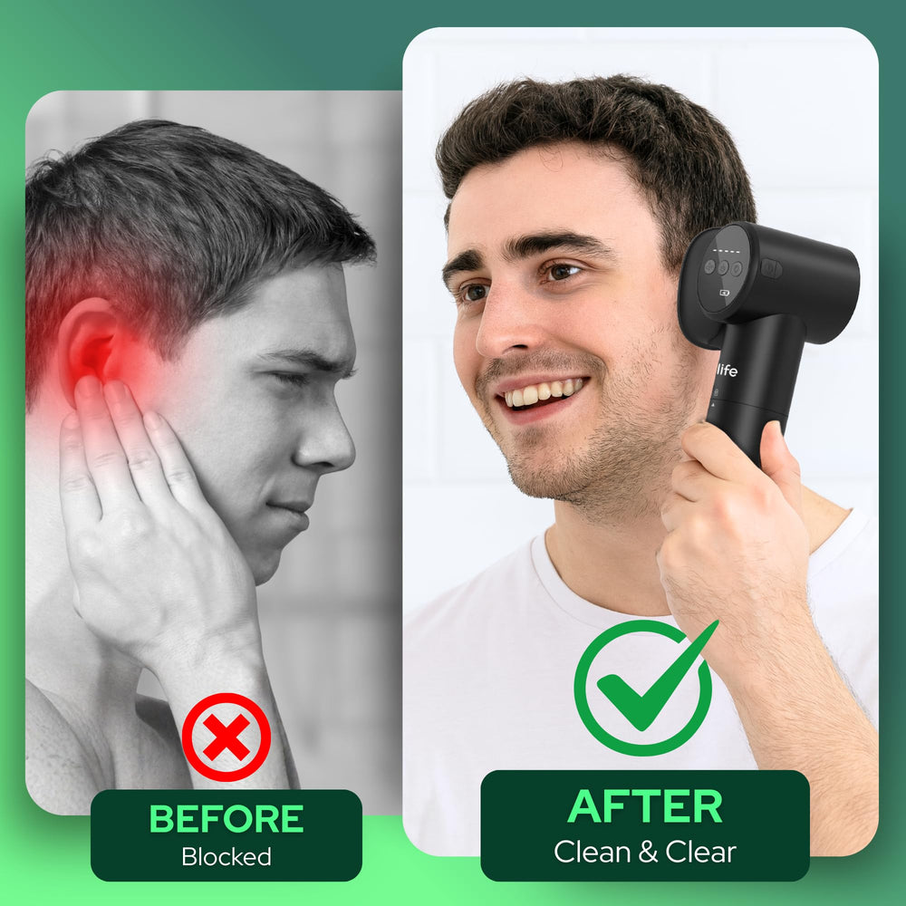 PROOLIFE dual-tank system used in hygienic ear flushing process.