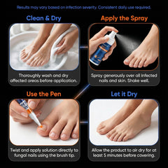 PUPCA damaged nail repair solution supports healthier looking nails.