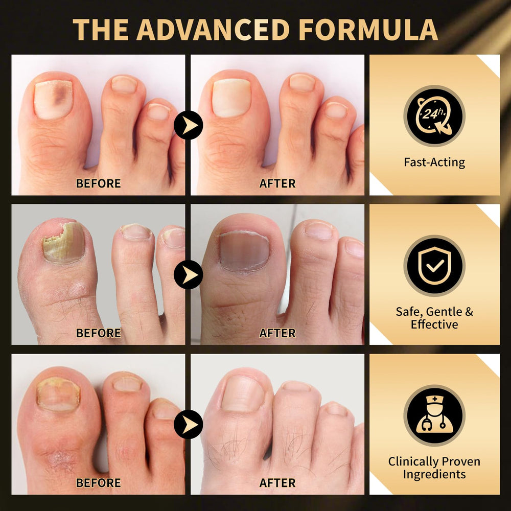 PUPCA natural plant extracts image emphasizes gentle plant-based ingredients.