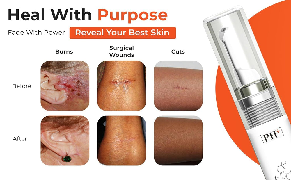 Scar area with improved texture and reduced redness
