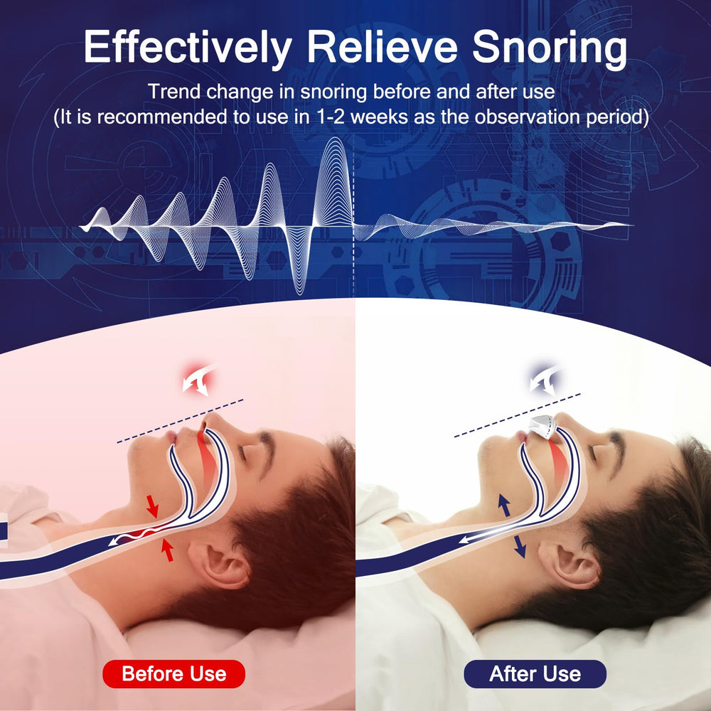 Redpee electric anti-snore device side view showing comfortable nostril fit