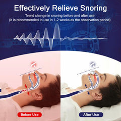 Redpee electric anti-snore device side view showing comfortable nostril fit