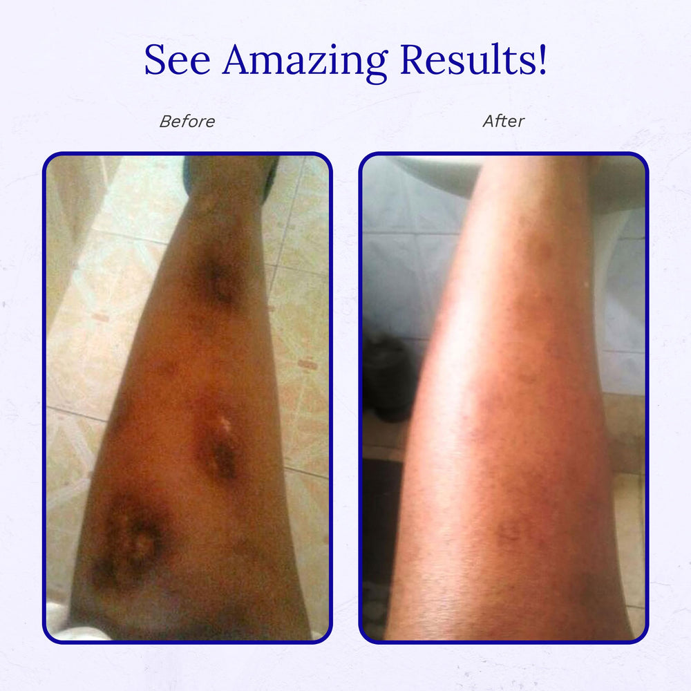 Translucent, non greasy RejuvaSil formula on skin during use