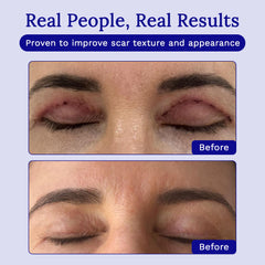 RejuvaSil with Vitamin C and silicone brightening scar tone.