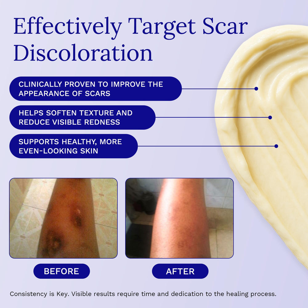 Rejuvaskin Scar Esthetique texture swirl highlights potent formula for discoloration