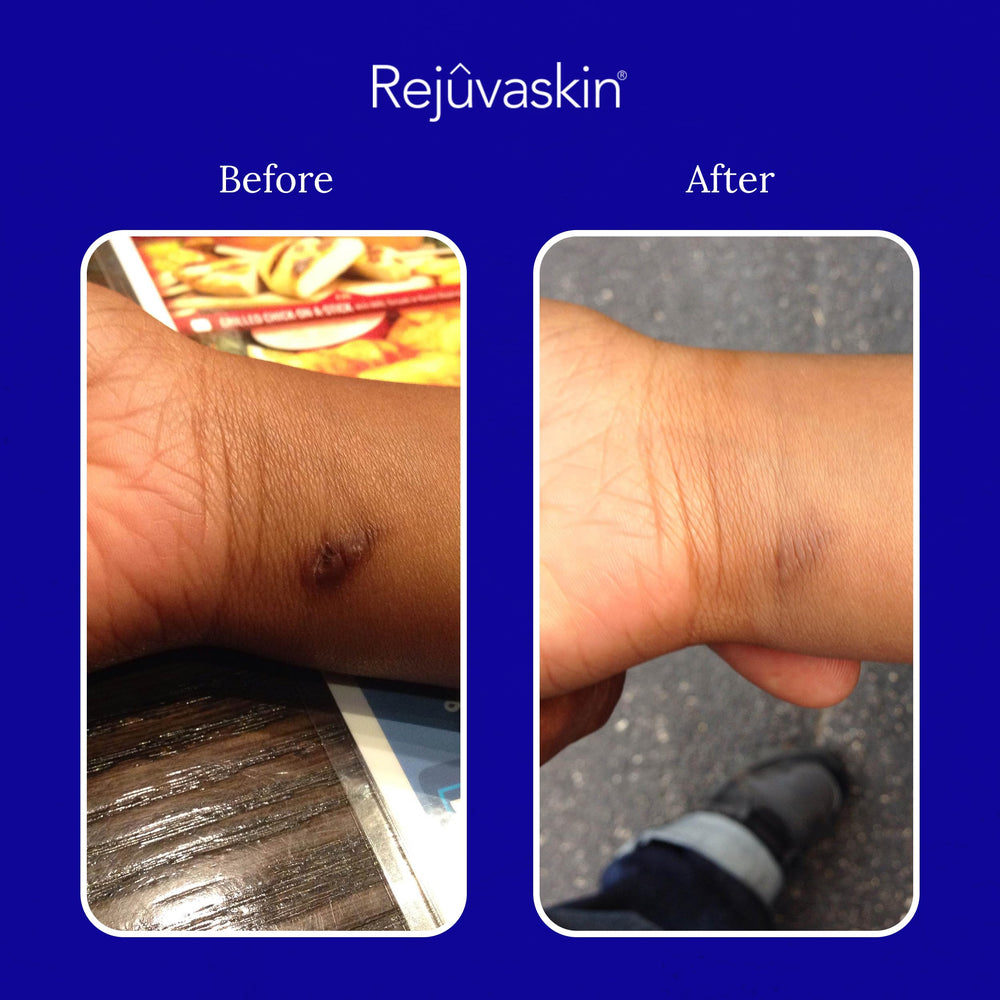 Skin-safe Scar FX silicone suitable for sensitive skin