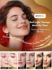 ROMISA 400 LEDs full-face coverage in use
