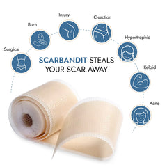 Scarbandit breathable scar patches in use for daily comfort