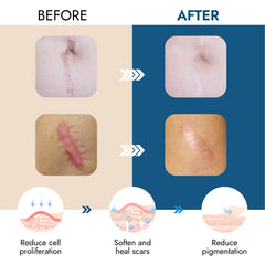 Scarbandit reusable scar sheets offering long term scar care
