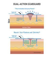 ScarGuard after-wound application may help minimize new scar formation.