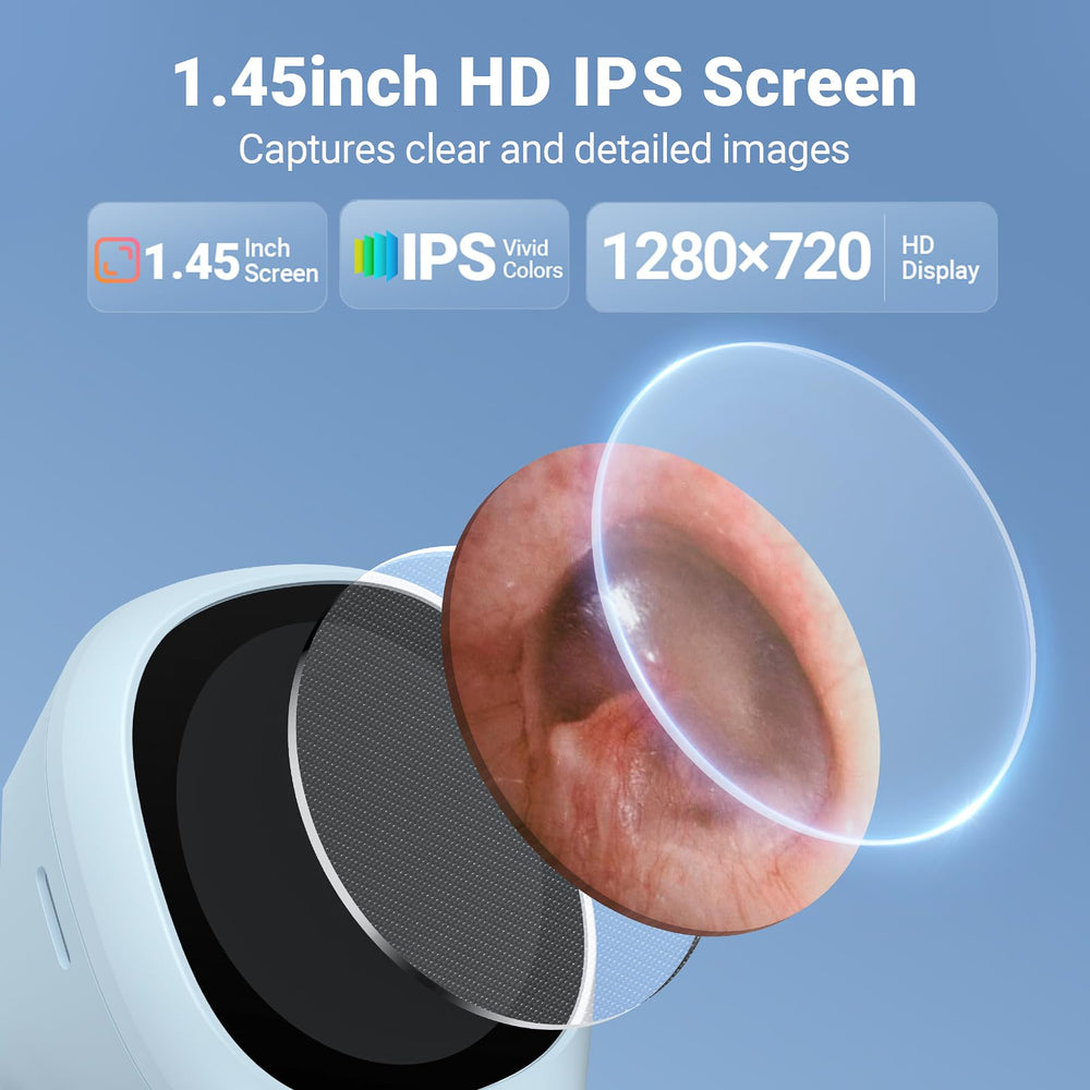 ScopeAround otoscope IPS display offers 720p imaging for detailed viewing.
