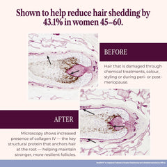 SEASON34 fuller-looking hair image promotes visible density and healthier strands.