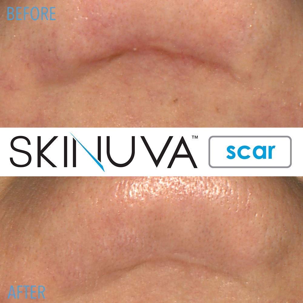 Cream applied on skin showing smooth, even distribution.