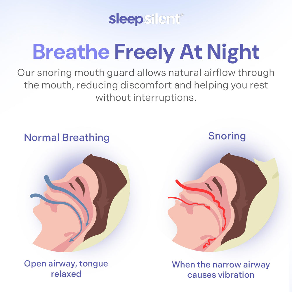 Sleep Silent snore-stopper heat-sensitive material closeup emphasizes personalized retention and comfort.