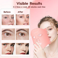Soeumoir 850nm near-infrared light for deeper penetration and skin conditioning.