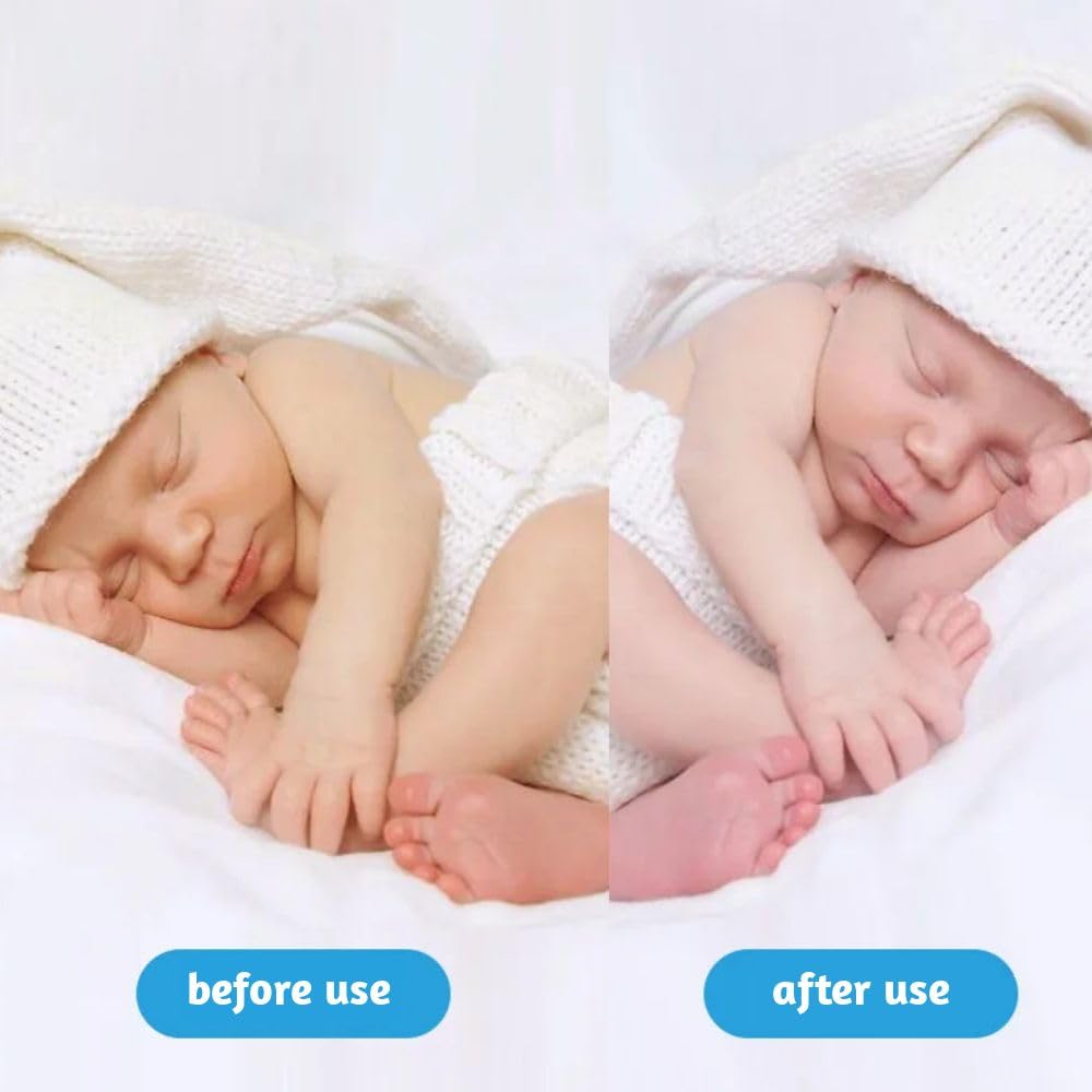 Stickfrease baby blue light skin friendly therapy in use