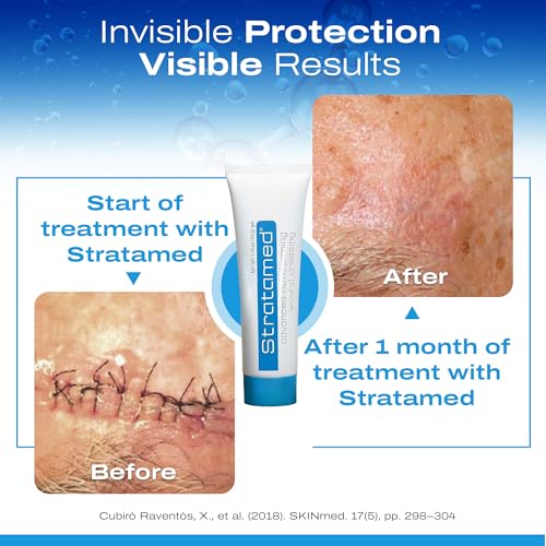Stratamed 50 g wound dressing packaging ready for convenient home use.