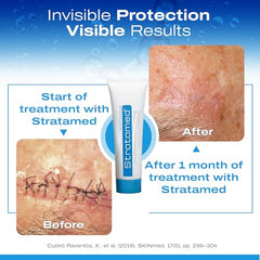 Stratamed 50 g wound dressing packaging ready for convenient home use.