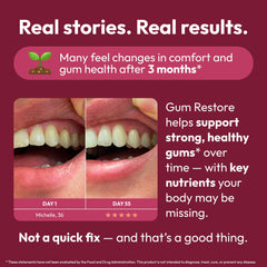 Strong Jaw Gum Restore daily-dose bottle—simple routine integration for oral wellness.
